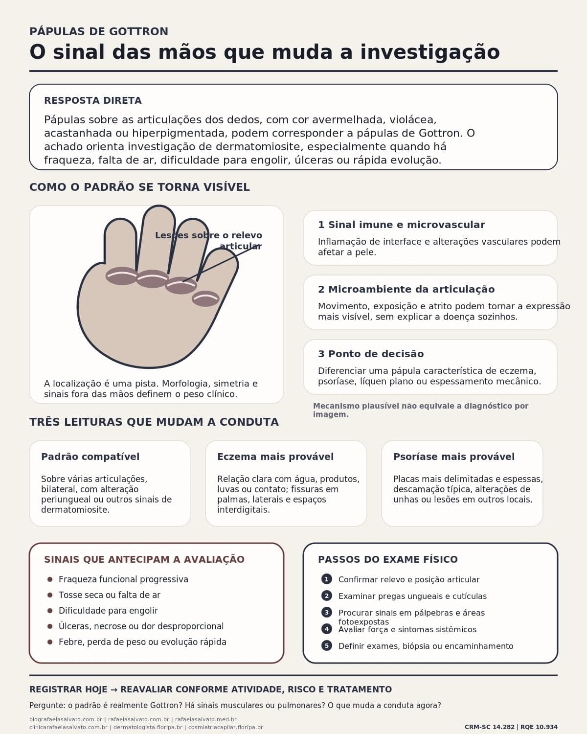 Infográfico editorial — Pápulas de Gottron: o sinal das mãos que orienta a investigação da dermatomiosite