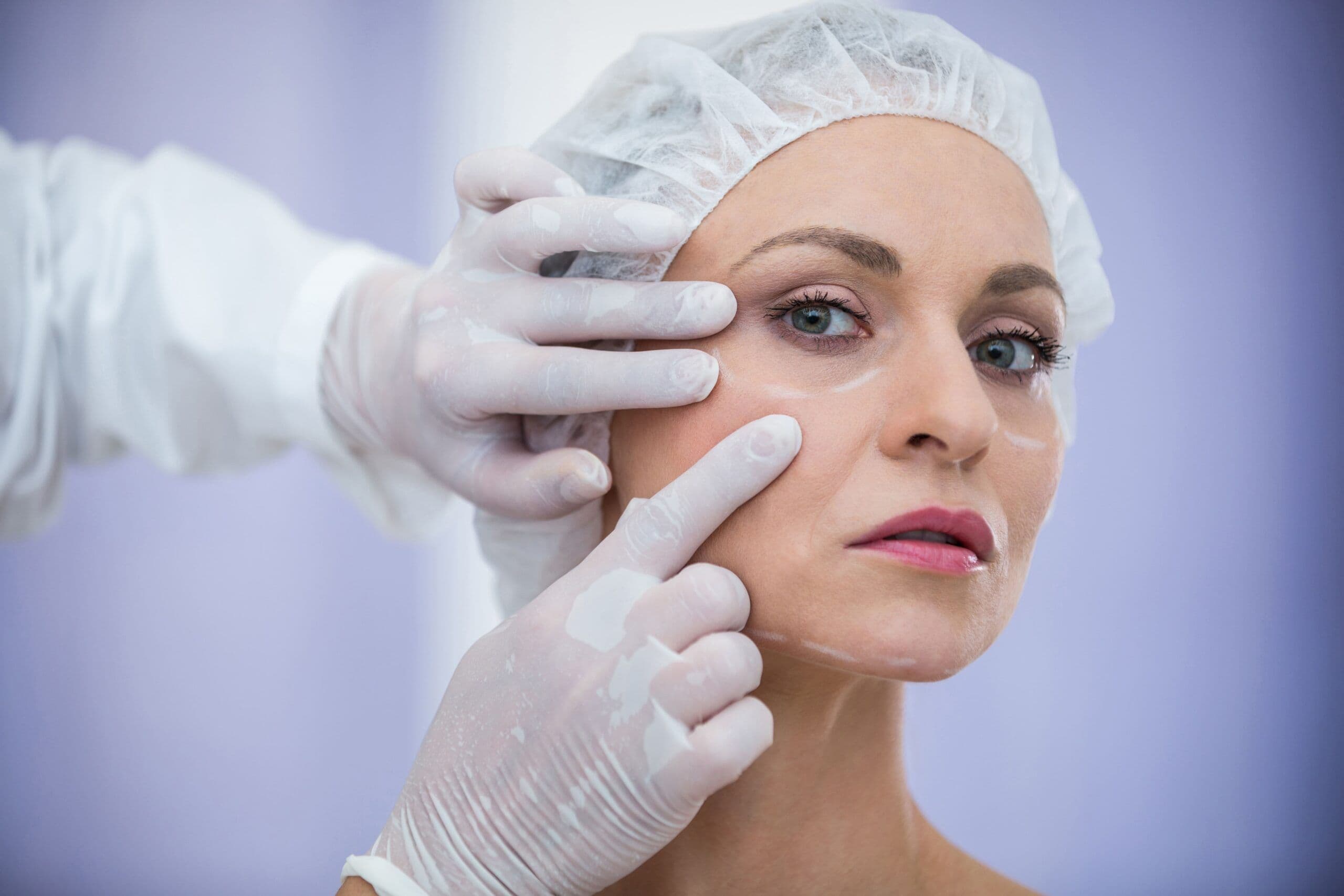 Dermatologista Dra. Rafaela Salvato aplica o tratamento de PDRN no rosto de uma paciente. A médica utiliza luvas e uma seringa de precisão para a bioestimulação e regeneração da pele